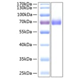 SDS-PAGE - Recombinant Human EPHA2 Protein (C-terminal His Tag) (A330570) - Antibodies.com