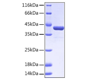 SDS-PAGE - Recombinant Human EPHA2 Protein (A330571) - Antibodies.com