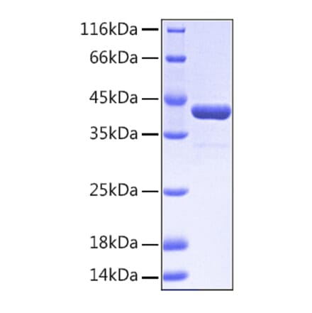 SDS-PAGE - Recombinant Human EPHA2 Protein (A330571) - Antibodies.com