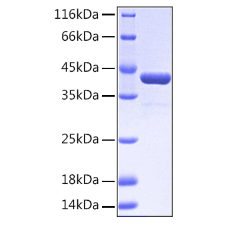 SDS-PAGE - Recombinant Human EPHA2 Protein (A330571) - Antibodies.com