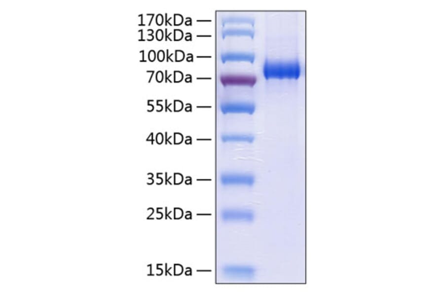 SDS-PAGE - Recombinant Human EPHA3 Protein (C-terminal His Tag) (A330572) - Antibodies.com