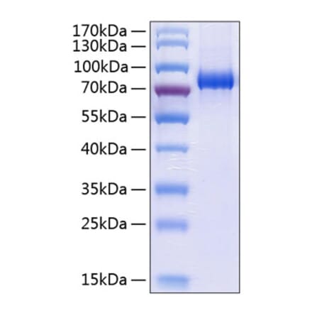 SDS-PAGE - Recombinant Human EPHA3 Protein (C-terminal His Tag) (A330572) - Antibodies.com