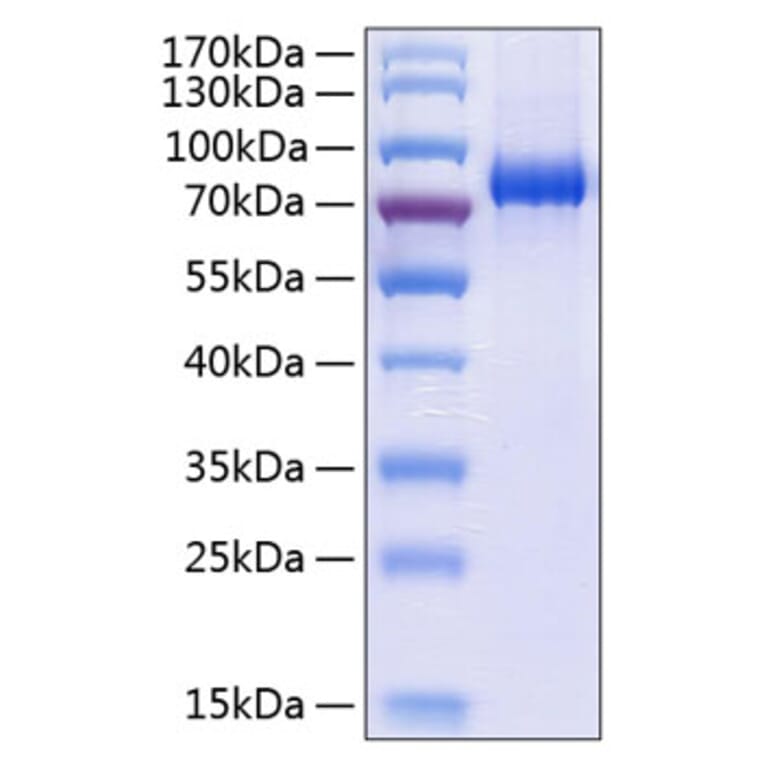 SDS-PAGE - Recombinant Human EPHA3 Protein (C-terminal His Tag) (A330572) - Antibodies.com