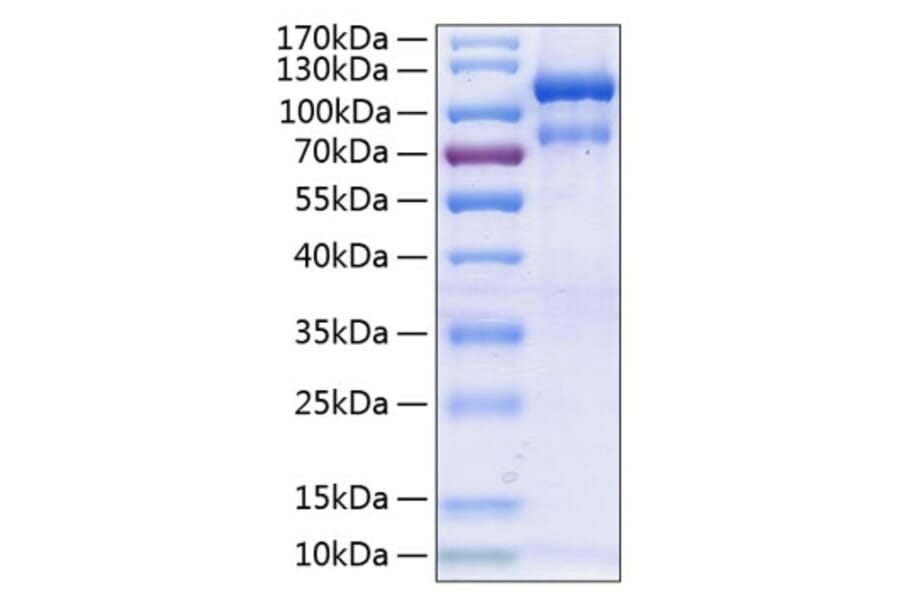 SDS-PAGE - Recombinant Human EPHA3 Protein (C-terminal Human Fc and His Tag) (A330573) - Antibodies.com