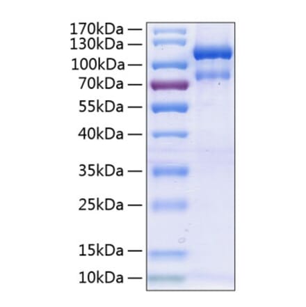 SDS-PAGE - Recombinant Human EPHA3 Protein (C-terminal Human Fc and His Tag) (A330573) - Antibodies.com