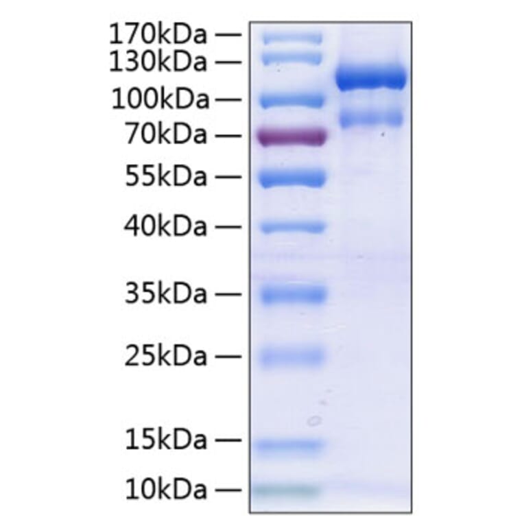 SDS-PAGE - Recombinant Human EPHA3 Protein (C-terminal Human Fc and His Tag) (A330573) - Antibodies.com