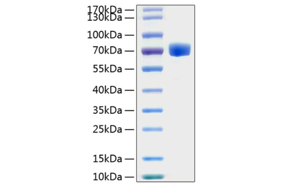 SDS-PAGE - Recombinant Human EPHA7 Protein (C-terminal His Tag) (A330574) - Antibodies.com