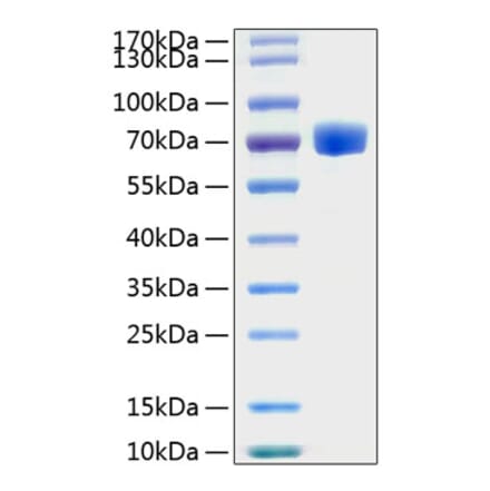 SDS-PAGE - Recombinant Human EPHA7 Protein (C-terminal His Tag) (A330574) - Antibodies.com
