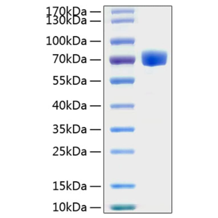 SDS-PAGE - Recombinant Human EPHA7 Protein (C-terminal His Tag) (A330574) - Antibodies.com