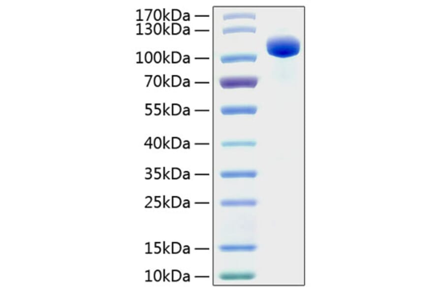 SDS-PAGE - Recombinant Human EPHB4 Protein (C-terminal Human Fc and His Tag) (A330575) - Antibodies.com