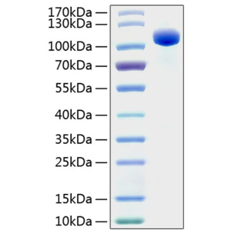 SDS-PAGE - Recombinant Human EPHB4 Protein (C-terminal Human Fc and His Tag) (A330575) - Antibodies.com