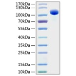 SDS-PAGE - Recombinant Human EPHB4 Protein (C-terminal Human Fc and His Tag) (A330575) - Antibodies.com