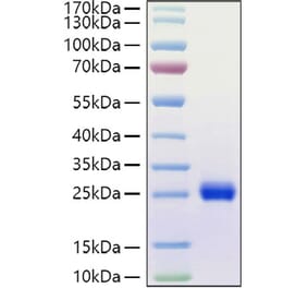 SDS-PAGE - Recombinant Human Ephrin A1 Protein (C-terminal His Tag) (A330576) - Antibodies.com
