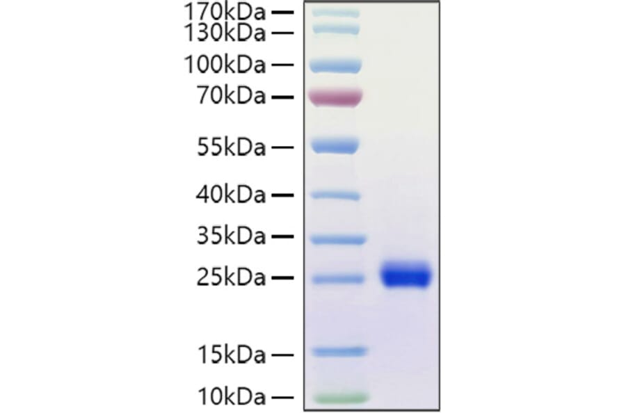 SDS-PAGE - Recombinant Human Ephrin A1 Protein (C-terminal His Tag) (A330576) - Antibodies.com