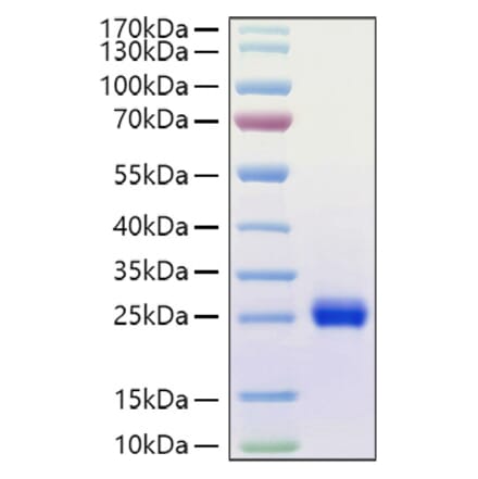 SDS-PAGE - Recombinant Human Ephrin A1 Protein (C-terminal His Tag) (A330576) - Antibodies.com