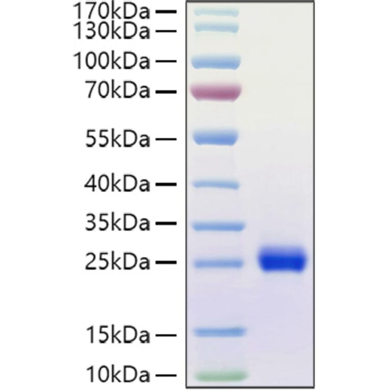 SDS-PAGE - Recombinant Human Ephrin A1 Protein (C-terminal His Tag) (A330576) - Antibodies.com