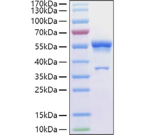 SDS-PAGE - Recombinant Human Ephrin A1 Protein (C-terminal Human Fc Tag) (A330577) - Antibodies.com