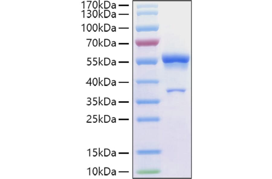 SDS-PAGE - Recombinant Human Ephrin A1 Protein (C-terminal Human Fc Tag) (A330577) - Antibodies.com