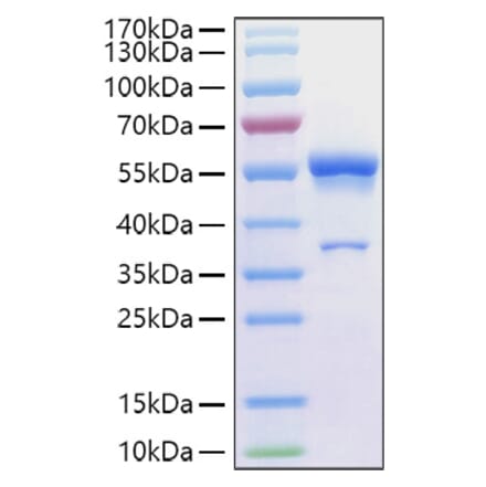 SDS-PAGE - Recombinant Human Ephrin A1 Protein (C-terminal Human Fc Tag) (A330577) - Antibodies.com