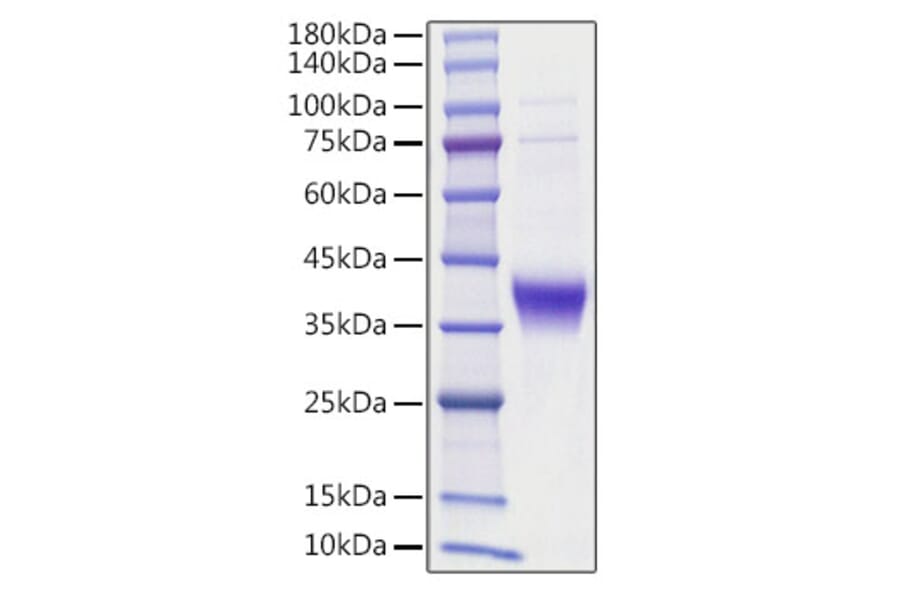 SDS-PAGE - Recombinant human Ephrin A3 Protein (C-terminal His Tag) (A330578) - Antibodies.com