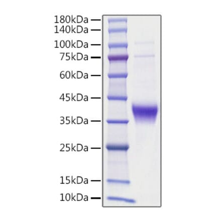 SDS-PAGE - Recombinant human Ephrin A3 Protein (C-terminal His Tag) (A330578) - Antibodies.com