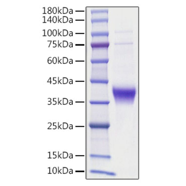 SDS-PAGE - Recombinant human Ephrin A3 Protein (C-terminal His Tag) (A330578) - Antibodies.com