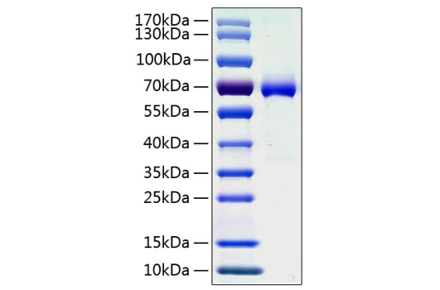 SDS-PAGE - Recombinant Human Ephrin A3 Protein (C-terminal Human Fc and His Tag) (A330579) - Antibodies.com