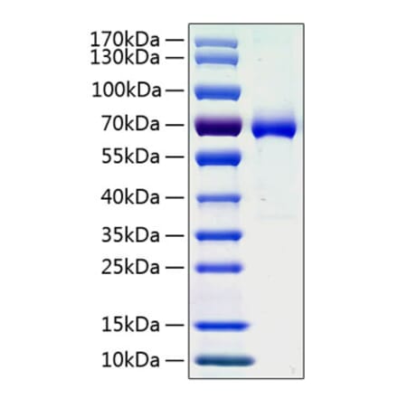 SDS-PAGE - Recombinant Human Ephrin A3 Protein (C-terminal Human Fc and His Tag) (A330579) - Antibodies.com