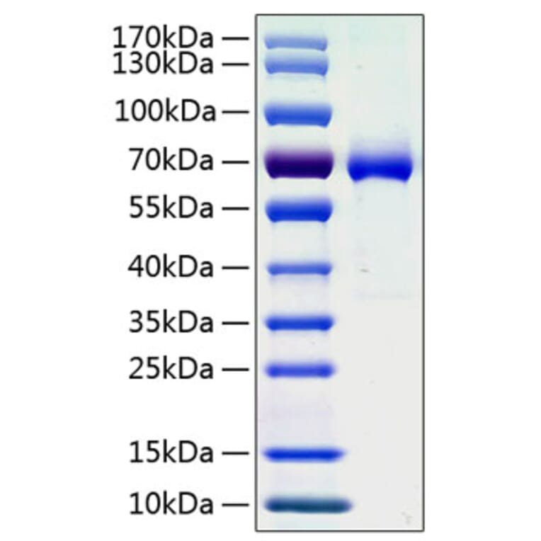 SDS-PAGE - Recombinant Human Ephrin A3 Protein (C-terminal Human Fc and His Tag) (A330579) - Antibodies.com