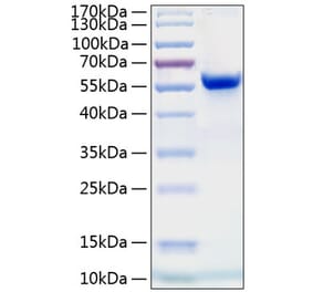 SDS-PAGE - Recombinant Human Ephrin A4 Protein (C-terminal Human Fc and His Tag) (A330580) - Antibodies.com