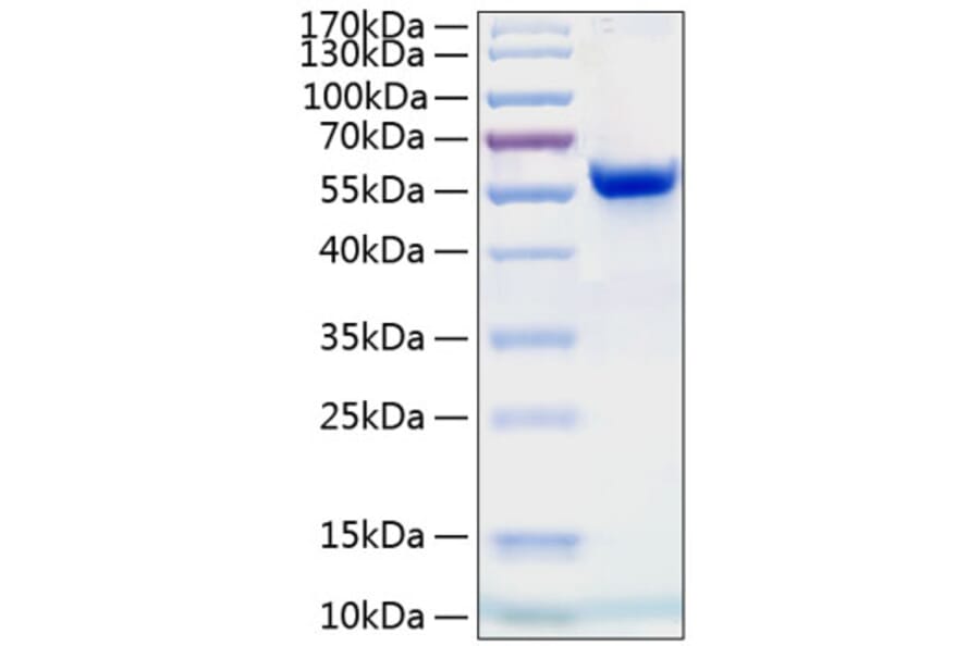 SDS-PAGE - Recombinant Human Ephrin A4 Protein (C-terminal Human Fc and His Tag) (A330580) - Antibodies.com