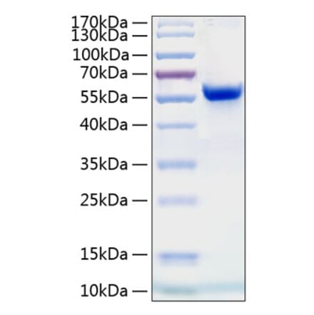 SDS-PAGE - Recombinant Human Ephrin A4 Protein (C-terminal Human Fc and His Tag) (A330580) - Antibodies.com