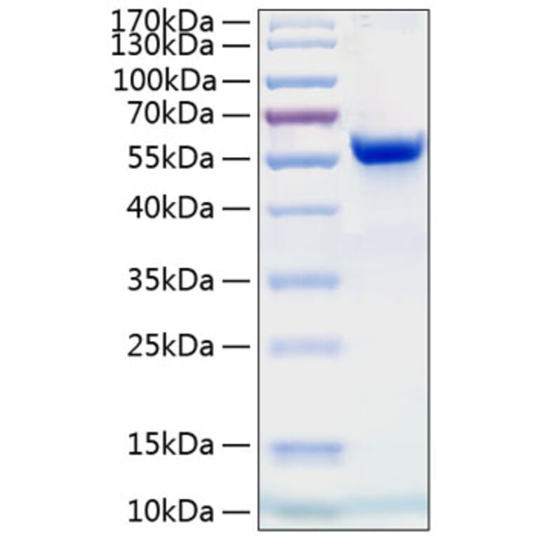 SDS-PAGE - Recombinant Human Ephrin A4 Protein (C-terminal Human Fc and His Tag) (A330580) - Antibodies.com