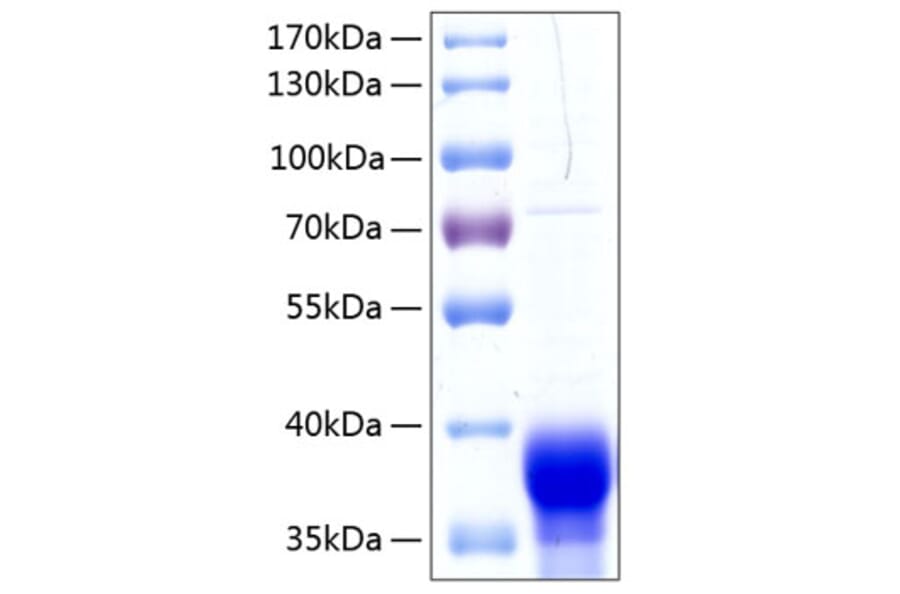 SDS-PAGE - Recombinant Human Ephrin B1 Protein (C-terminal His Tag) (A330581) - Antibodies.com