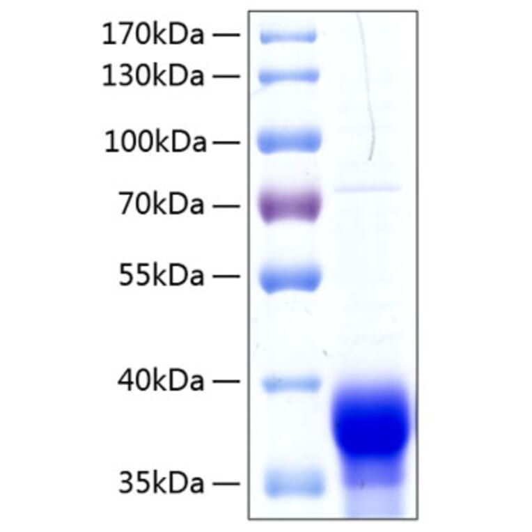 SDS-PAGE - Recombinant Human Ephrin B1 Protein (C-terminal His Tag) (A330581) - Antibodies.com