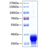 SDS-PAGE - Recombinant Human Ephrin B1 Protein (C-terminal His Tag) (A330581) - Antibodies.com