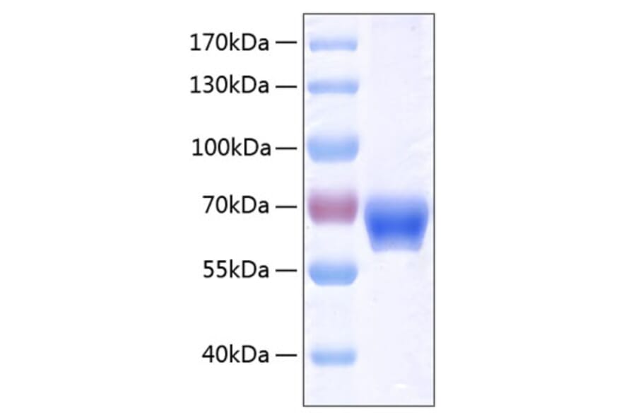SDS-PAGE - Recombinant Human Ephrin B1 Protein (C-terminal Human Fc and His Tag) (A330582) - Antibodies.com