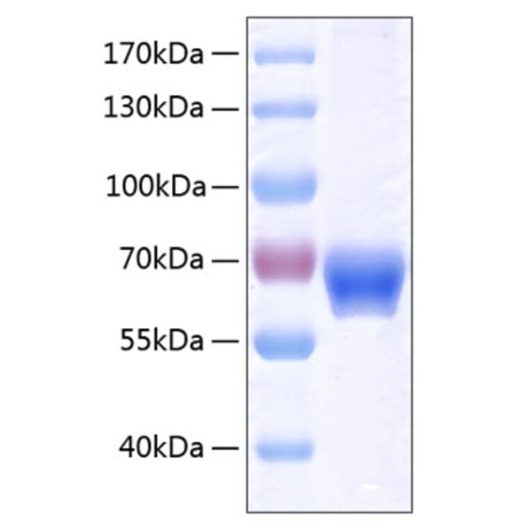 SDS-PAGE - Recombinant Human Ephrin B1 Protein (C-terminal Human Fc and His Tag) (A330582) - Antibodies.com