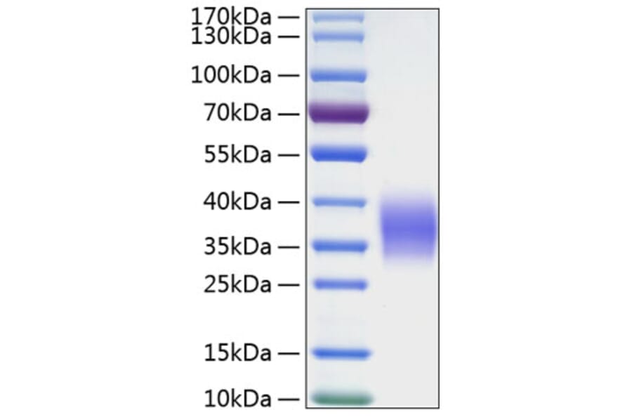 SDS-PAGE - Recombinant Human Ephrin B2 Protein (C-terminal His Tag) (A330583) - Antibodies.com