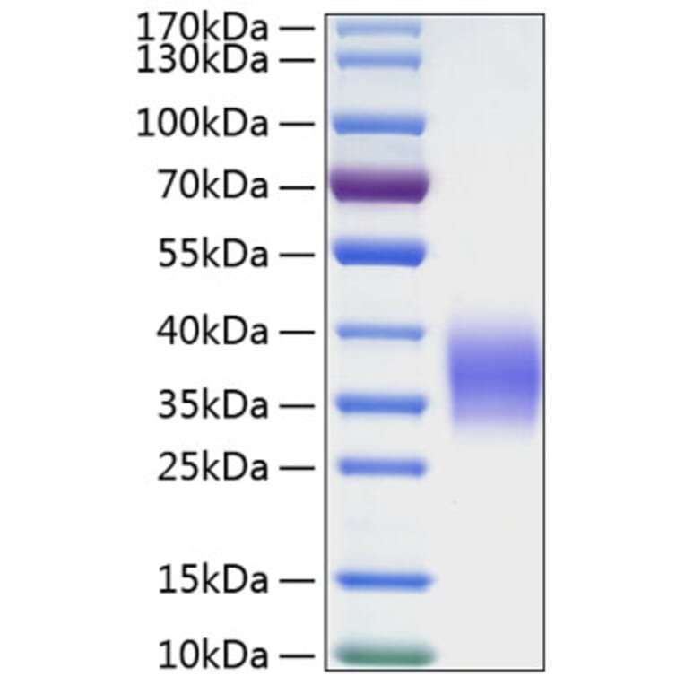 SDS-PAGE - Recombinant Human Ephrin B2 Protein (C-terminal His Tag) (A330583) - Antibodies.com