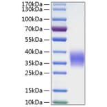 SDS-PAGE - Recombinant Human Ephrin B2 Protein (C-terminal His Tag) (A330583) - Antibodies.com