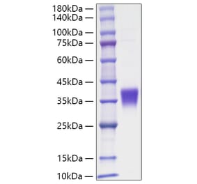 SDS-PAGE - Recombinant Human EPO Protein (C-terminal His Tag) (A330584) - Antibodies.com