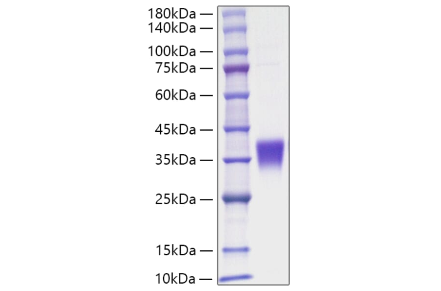 SDS-PAGE - Recombinant Human EPO Protein (C-terminal His Tag) (A330584) - Antibodies.com