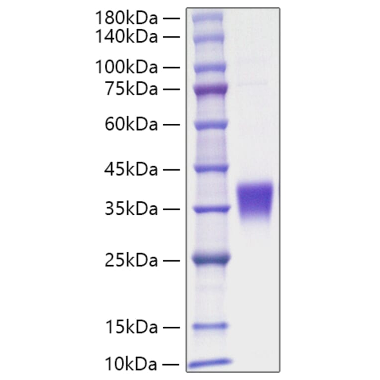 SDS-PAGE - Recombinant Human EPO Protein (C-terminal His Tag) (A330584) - Antibodies.com