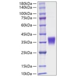 SDS-PAGE - Recombinant Human EPO Protein (C-terminal His Tag) (A330584) - Antibodies.com
