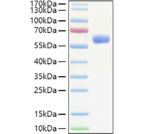 SDS-PAGE - Recombinant Human EPO Protein (C-terminal Human Fc Tag) (A330585) - Antibodies.com