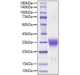 SDS-PAGE - Recombinant Human EPO Protein (A330586) - Antibodies.com