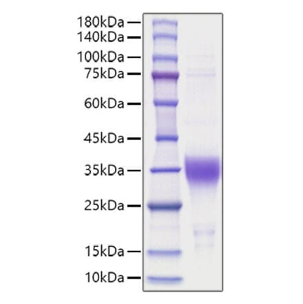 SDS-PAGE - Recombinant Human EPO Protein (A330586) - Antibodies.com