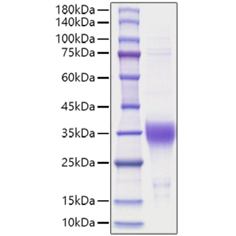SDS-PAGE - Recombinant Human EPO Protein (A330586) - Antibodies.com