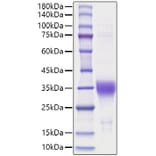 SDS-PAGE - Recombinant Human EPO Protein (A330586) - Antibodies.com